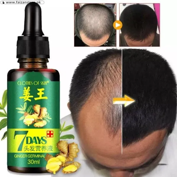 7 Days spray Hair Growth Germinal Oil In Pakistan